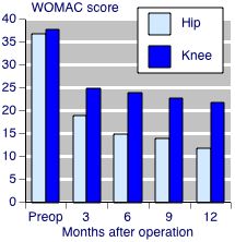 WOMAC KNEE SCORE- Patient Reported Outcome Tool